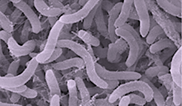 Mikroskopbild av bakterier